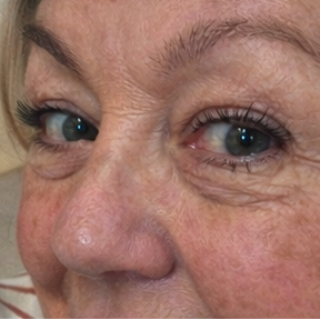 Yeux sensibles et j'ai pas eu de problème.